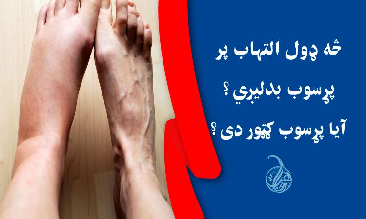 څه ډول التهاب پر پړسوب بدليږي؟ آيا پړسوب ګټور دی؟ 